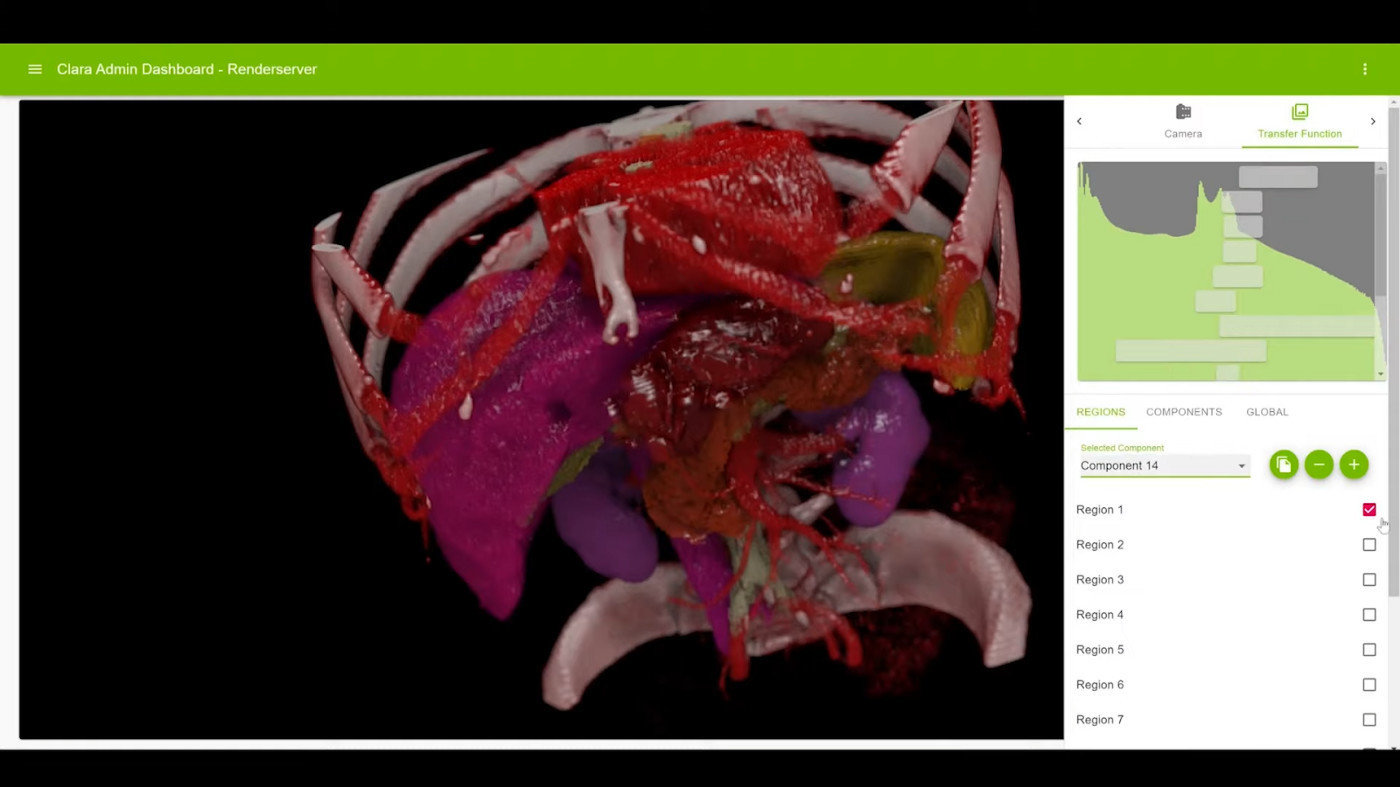 放射科醫師在 NVIDIA Clara Holoscan 平台上可以透過人工智慧自動辨識骨骼、內臟與血管