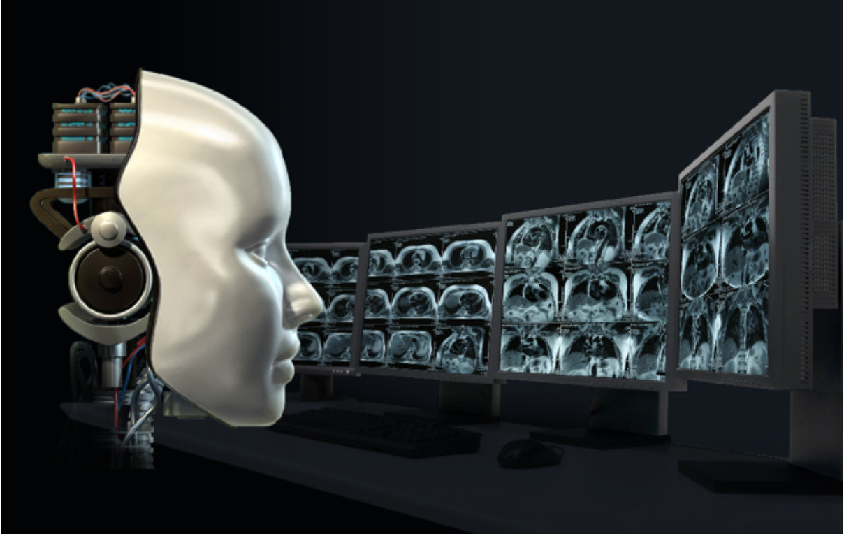 人工智慧從醫療影像中早期診斷癌症
